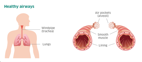 Image of healthy airways